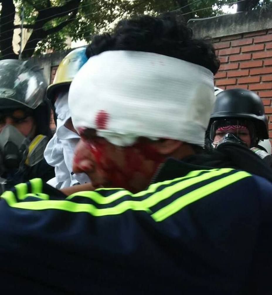 #3jun Tres heridos por perdigones durante protesta en Montalbán