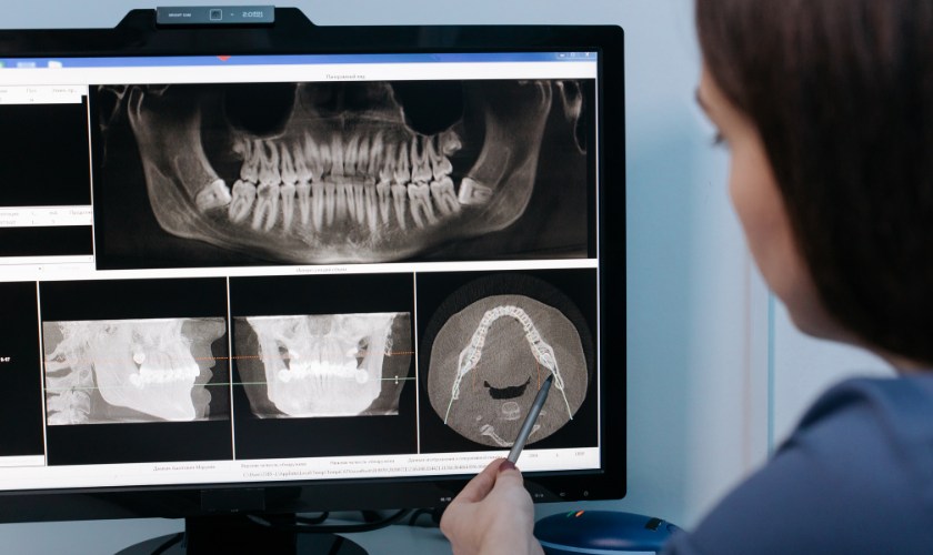 ¿Puede la Salud Bucodental Afectar tu Cerebro? Descubre la Verdad Científica +Video